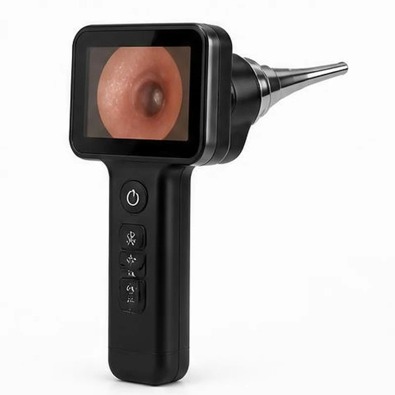 Digital Video Otoscope